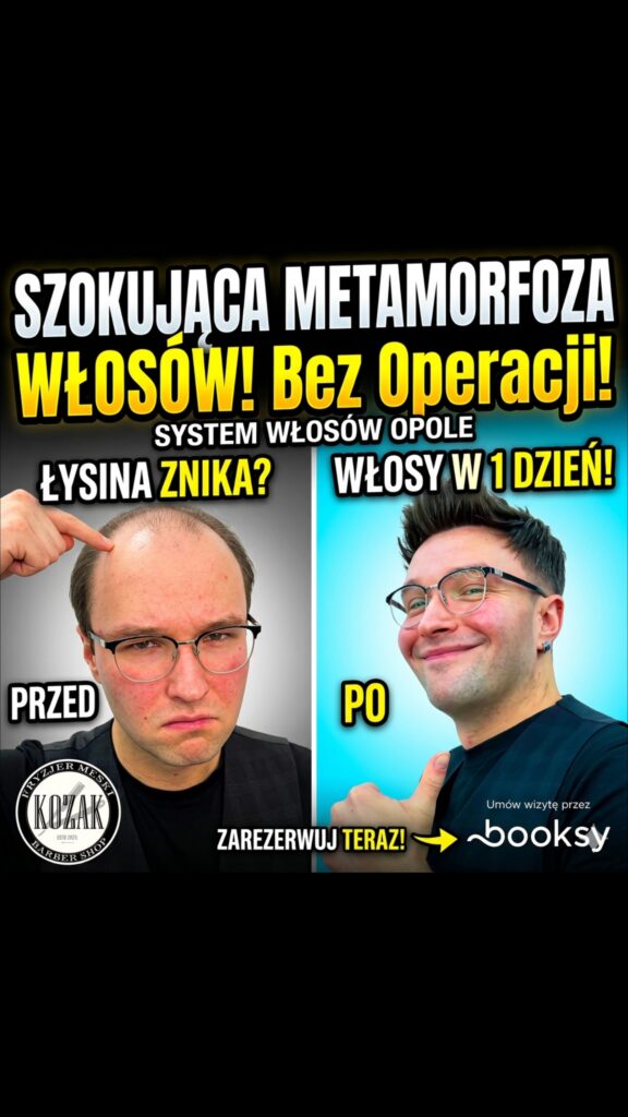 Szokująca metamorfoza naszego klienta bez operacji . Opole